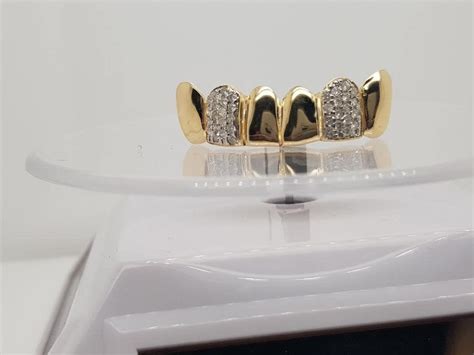 grillz las vegas|Grillz in Las Vegas, NV – Iceberg Diamonds at。